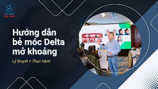 Thực hành chỉnh nha: Hướng dẫn bẻ móc Delta đóng khoảng