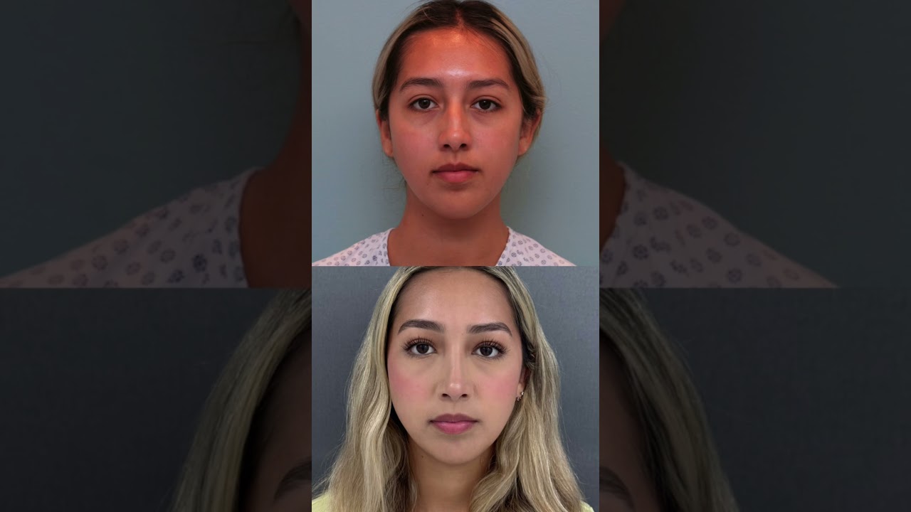 Angel Castro Urquizo-235