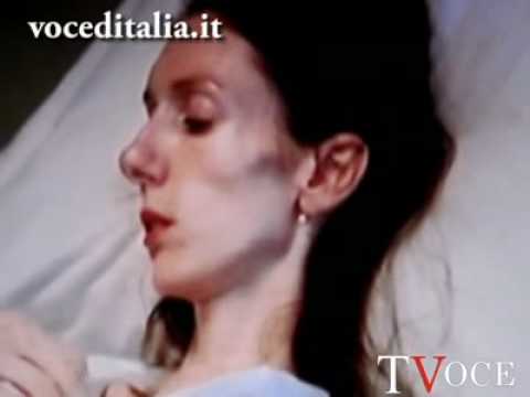 Pomata da osteocondrosi tedesco Dolore alla schiena dopo la tensione nervosa