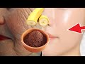 The Strongest Collagen With Coffee Makes You Younger Than 17 Years Old Fights Wrinkles In The Face