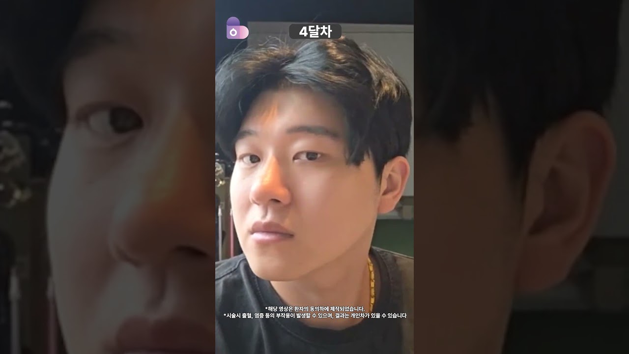 남자 얼굴, 눈 코로 분위기를 바꾸다!