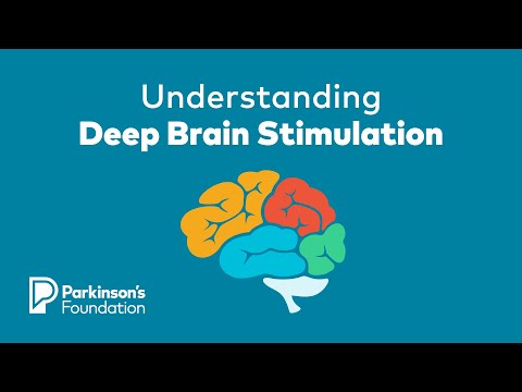 Deep Brain Stimulation: Patient Selection & Outcomes