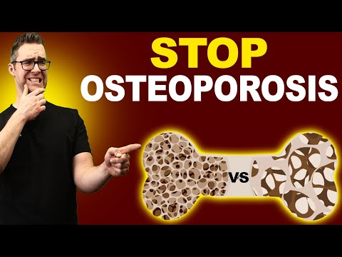 The 1 Calcium Osteoporosis Vitamin D BIG MISTAKE