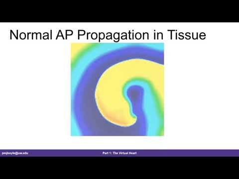 Modeling and Simulation of Cardiac Arrhythmia, February 28, 2020