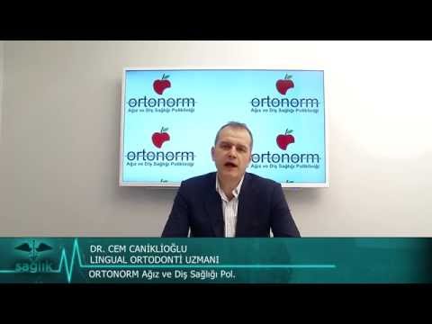 Dr. Cem Caniklioğlu (Ortodontist) - Lingual Ortodonti Tedavisi 