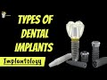 DENTAL IMPLANTS : TYPES, SURFACE TREATMENTS, why TITANIUM is used for making implants?