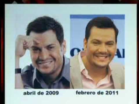 SuperXclusivo 2/16/11 - Fotos antes y después de Victor Manuelle