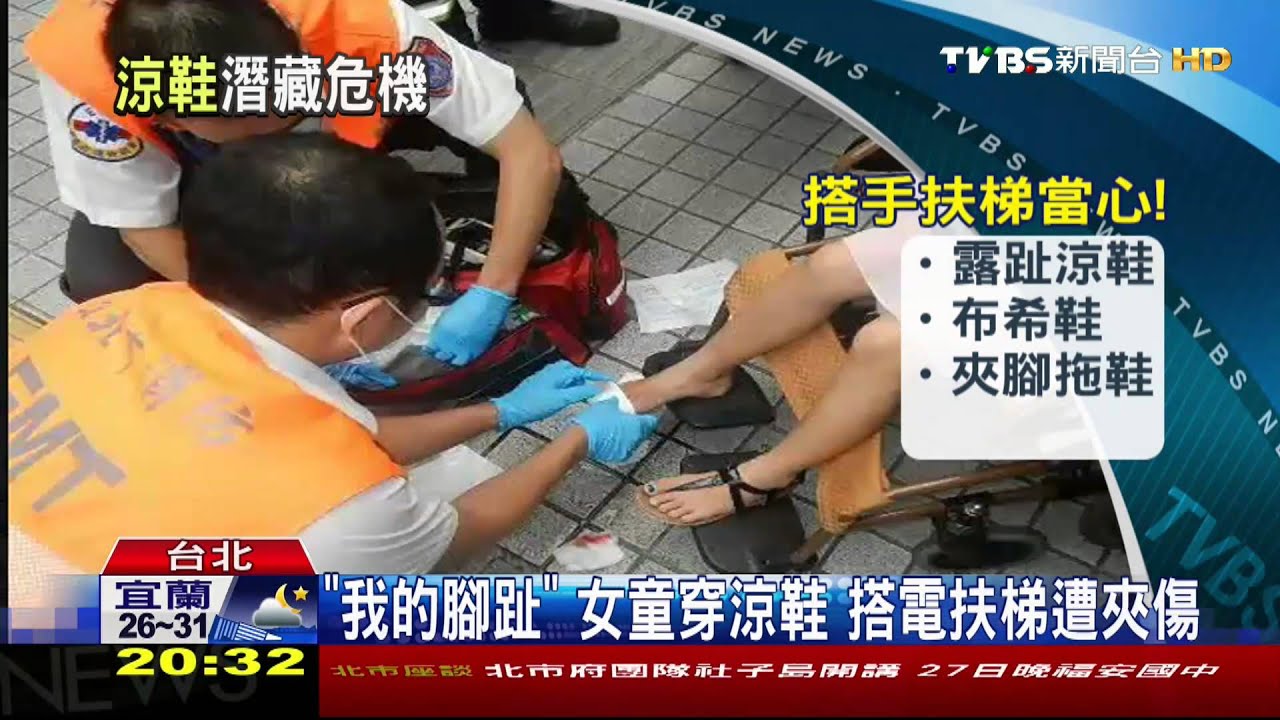 「我的腳趾」女童穿涼鞋 搭電扶梯遭夾傷