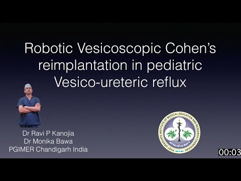 Robotic Vesicoscopic Cohen’s reimplantation for pediatric vesicoureteric reflux