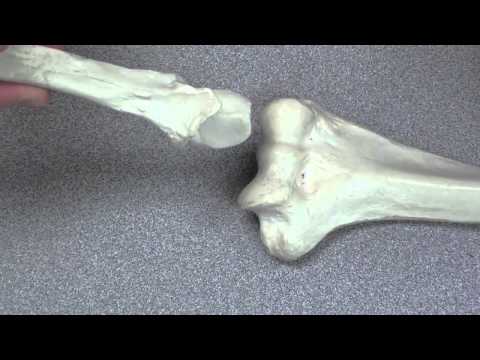 Distal Humerus