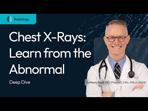 Deep Dive video thumbnail