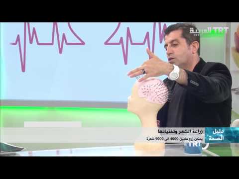 ماذا عن تطور زراعة الشعر
