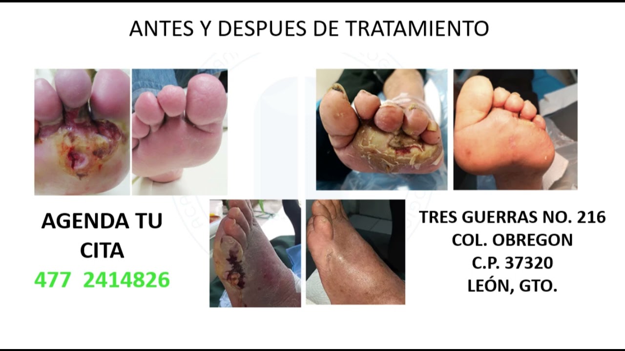 Marco Antonio Ayala García-23