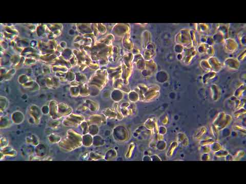 Кровь под микроскопом MAGUS Bio 270