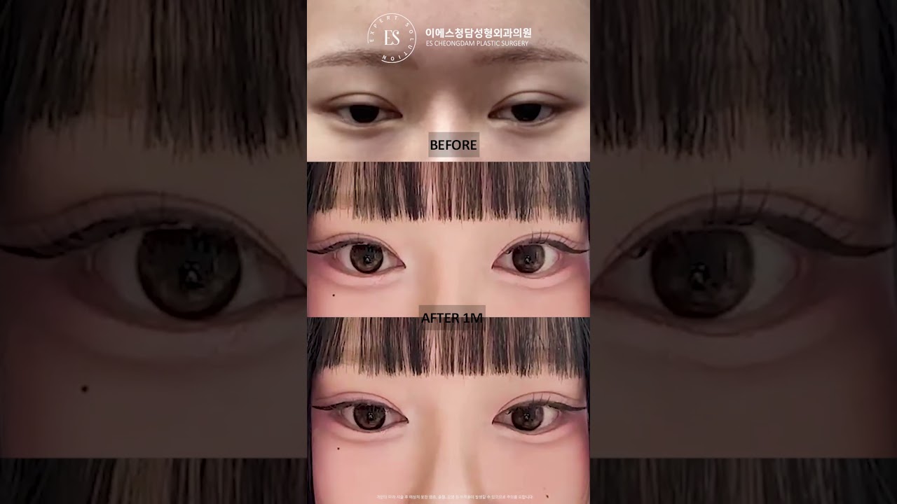 이에스 유튜브