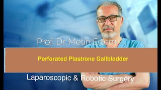 Miniaturka - Perforated Plastrone Gallbladder. Metin Ertem MD.FACS.