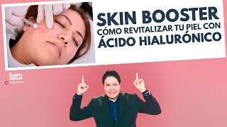 SKIN BOOSTER. COMO REVITALIZAR LA PIEL CON ACIDO HIALURONICO || DR MARINO DERMATOLOGO
