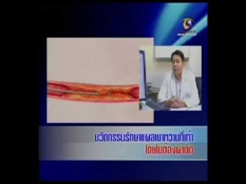น้ำมันโจโจบาการแสดงความคิดเห็นกลาก สังกะสี 10 สำหรับโรคสะเก็ดเงิน