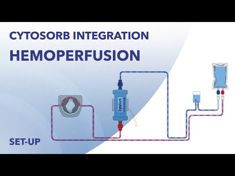 CytoSorb set-up stand alone application