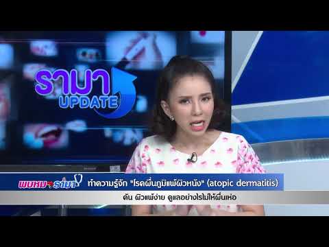 รังสีรักษาโรคสะเก็ดเงิน ซาลิไซลิสารละลายแอลกอฮอล์กรดของโรคสะเก็ดเงิน