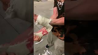 LEON SI TOGLIE FINALMENTE IL GESSO.. 😍 #vitadaskater #skate #skateboarding