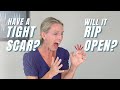 Is Tight Scar Tissue Limiting Movement Of Your Hand Or Finger Get 3 Tight Scar Tissue Treatments