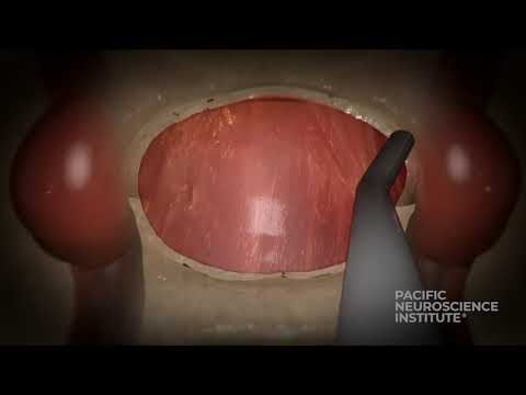 Endoscopic Endonasal Pituitary and Skull Base Surgery