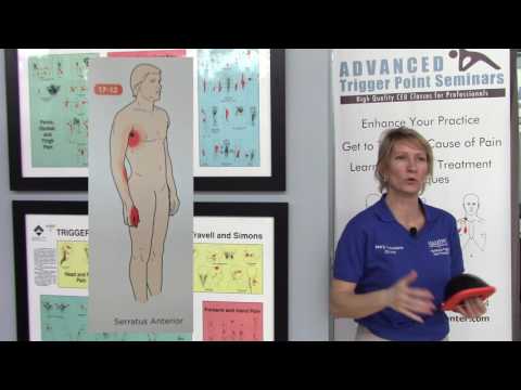 Carpal Tunnel Pain? Could be referred pain from the Serratus Anterior Muscle