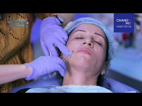 حقن الفيلر حول الفم فيلر الخطوط التعبيرية للفم والانف change me clinic