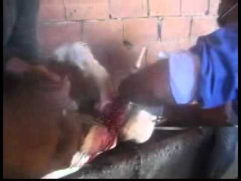 comment traiter acrochordons