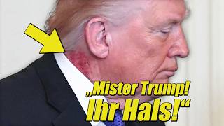 ÜBLE Stelle Am Hals Von Trump Lässt Keinen ZWEIFEL Mehr!