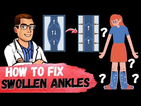 Heel Spurs Plantar Fasciitis BEST Home Treatment 2022