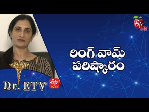 Ringworm - Treatment | రింగ్ వామ్ - పరిష్కారం | Dr.ETV | 18th April 2022 | ETV Life