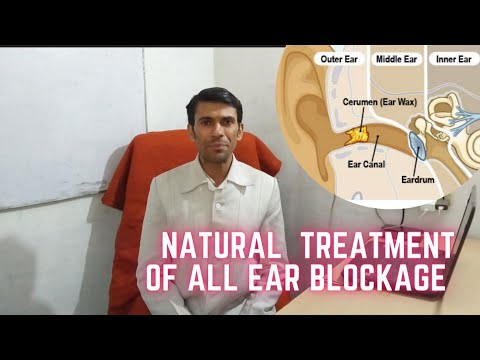 Natural Treatment of All Ear Blockage