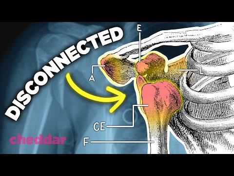 Why The Human Shoulder Is A Design Disaster - Cheddar Explains