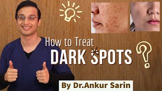 How to remove dark spot | Dark Spots Skin Care Routine | Dr. Ankur Sarin