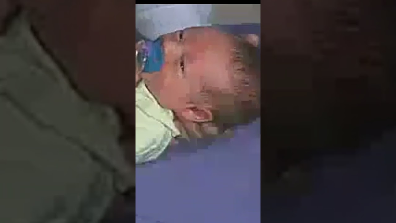 Conheça o Reflexo de Moro #medicina #curiosidades #pediatria