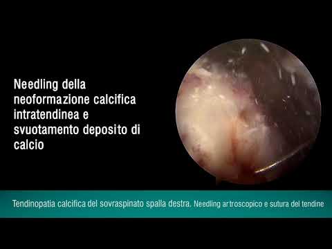 Norme per la fornitura di assistenza ambulatoriale in osteocondrosi Scoliosi del trattamento livello lombare 1