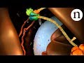RNA interference (RNAi): by Nature Video