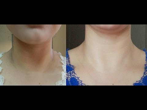 Kepe at beetroot diyeta recipe at mga review Slimming stop