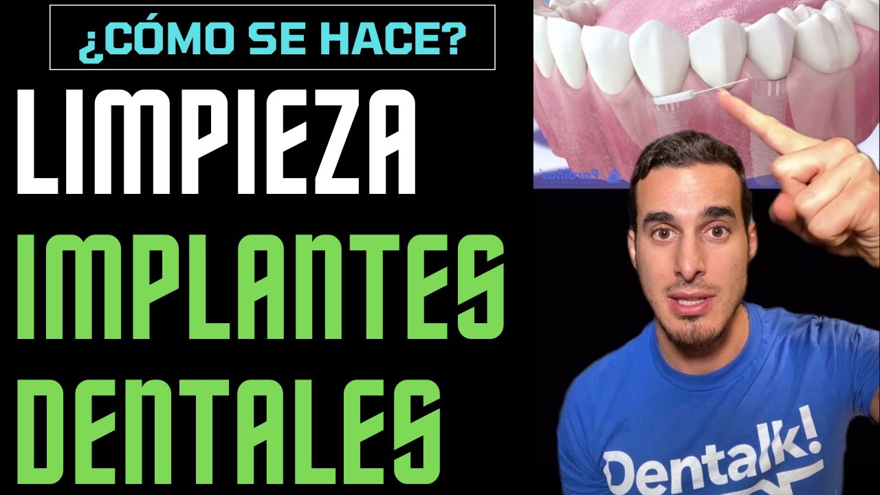 Watch 🪥 Cómo LIMPIAR correctamente los IMPLANTES DENTALES Now 🪥 Cómo LIMPIAR correctamente los IMPLANTES DENTALES