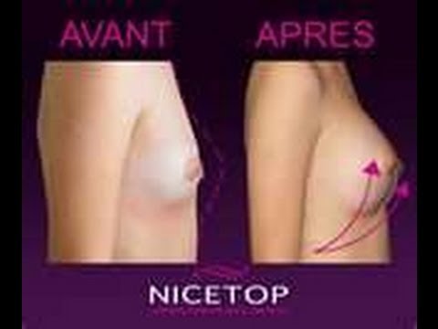 comment appliquer la creme nicetop