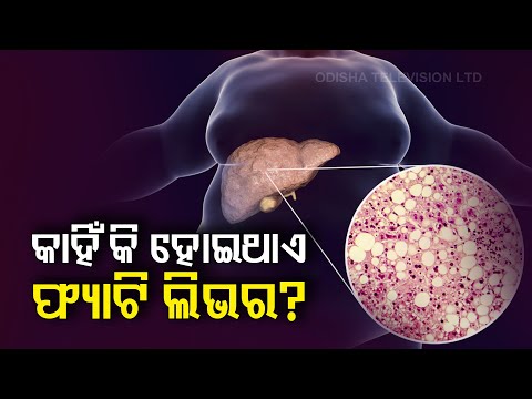What Leads To Fatty Liver