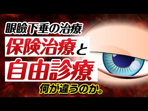 医学科 眼瞼下垂の治療における保険治療と非保険治療の違いとは？