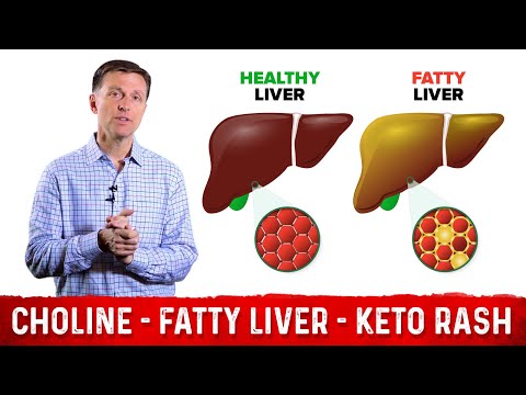 How Your Feet Are Warning You About Your Liver Problems Dr Berg Explains