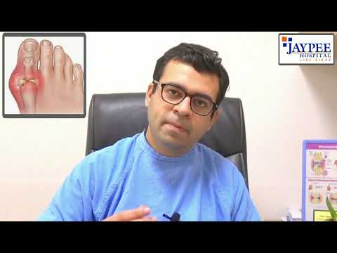 Know how to deal with Uric Acid and Gout (in Hindi) - Dr Suvrat Arya, Rheumatologist Jaypee Hospital