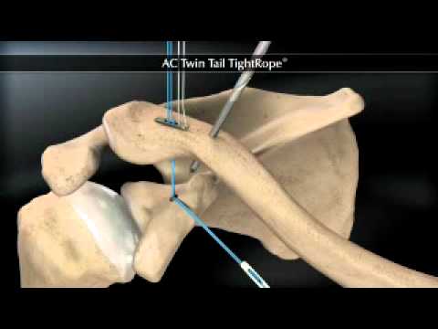 Counterpain unguent farmacii