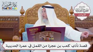 [805] قصة تأذي كعب بن عجرة من القمل في عمرة الحديبية - عثمان الخميس