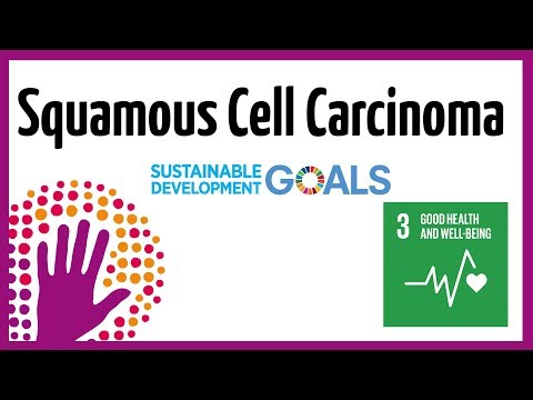 太陽和皮膚鱗狀細胞癌。 (Sun And Squamous Cell Carcinoma Of The Skin)