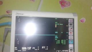 Download lagu Mesin pengukur detak jantung mp3